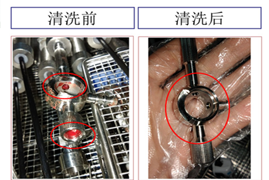 真空超聲波清洗機(jī),輕松解決醫(yī)療器械清洗難題